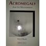 Acromegaly and Its Management