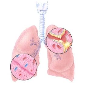 Click here to buy Bronchitis Mix Capsules by The Herbal Gardens of South Florida Inc..