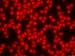 Micrograph Pernicious Anemia Red Blood Cells Photographic Poster Print, 18x24