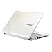 Video Games : MSI Wind U100-030US 10-Inch Netbook (1.6 GHz Intel Atom Processor, 1 GB RAM, 120 GB Hard Drive, XP Home, 3 Cell Battery) Pearl White Heart