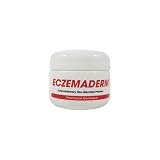 31LCYWVqufL. SL160  Eczema What You Need To Know About Eczema Treatment?