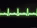Electrocardiogram Trace Photographic Poster Print by David M. Dennis, 24x18