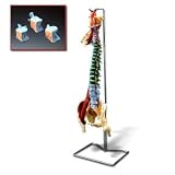Muscle Spine W/Disorders + Stand CH5900
