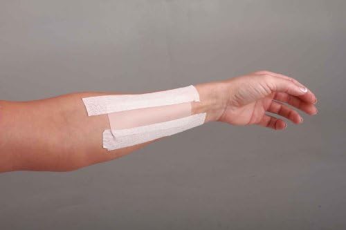 Rejuveness Silicone Sheet 4 cm X 25 cm (1.6 "X 10") Guranteed Scar Treatmente Includes 1 Washable and Reusable Silicone Sheet. Effective for 6 Months of Treatment - Results in 1 - 2 Weeks - Average Healing Time 1 - 3 Months.