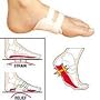 FootSmart Men's / Women's Arch Brace