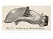 Diagram to Show How the Matrisalus Cap is Held for Inserting into the Vagina Art Gicl...