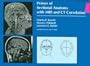 Primer of Sectional Anatomy With Mri and Ct Correlation