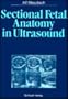 Sectional Fetal Anatomy in Ultrasound