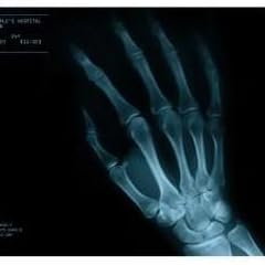 マウスパッド レントゲン風 右手