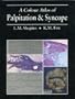 A Colour Atlas of Palpitation and Syncope