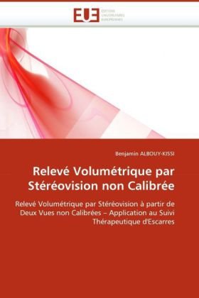 Relevé Volumétrique par Stéréovision non Calibrée: Relevé Volumétrique par Stéréovision à partir de Deux Vues non Calibrées ? Application au Suivi Thérapeutique d'Escarres (French Edition)
