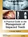 A Practical Guide to the Management of Impacted Teeth