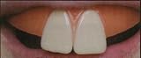Bunny Clown Teeth