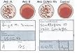 Blood Type Eldoncard Typing Test Kit Includes: 1 Eldoncard, lancet, gauze, alcohol wipe, micropipette