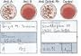 Blood Type Eldoncard Typing Test Kit Includes: 1 Eldoncard, lancet, gauze, alcohol wipe, micropipette
