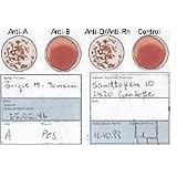 Blood Type Eldoncard Typing Test Kit Includes: 1 Eldoncard, lancet, gauze, alcohol wipe, micropipette