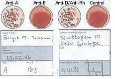 EldonCard Home Blood Type Test Kits(2ea Eldoncard Test Kits)- Test Results in Minutes! One Fast Flat Shipping Rate! Test Results Guaranteed!