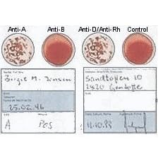EldonCard Home Blood Type Test Kit- Test Results Guaranteed!