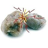 Piezo-Electric Rocks