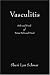 Vasculitis: Sick and Tired of Being Sick and Tired