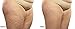 Cellulite Massager and Remover Treatment - Look Gorgeous Look Sexy - Beauty Body Brush Scrub Mitt Tool