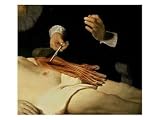 The Anatomy Lesson of Dr. Nicolaes Tulp, 1632 Art Giclee Poster Print by Rembrandt van Rijn, 24x18