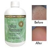Be Natural Orange Callus Eliminator 4 Oz Free Shipping thumbnail