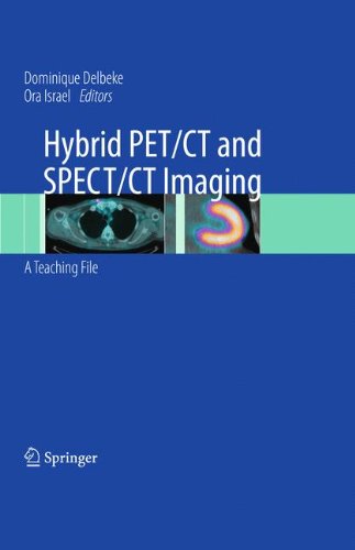 Hybrid PET/CT and SPECT/CT Imaging: A Teaching FileFrom Springer