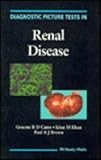 Diagnostic picture tests in renal disease