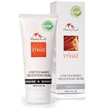 Anti Striae – Stretch Marks Prevention Cream