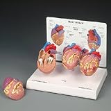 Mini Heart Set Model