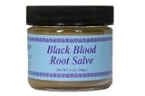 Black Blood Root Salve 2 oz. - Natural Herbal Escharotic