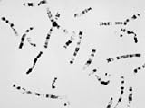 Human Chromosomes, Free Showing Banding Photographic Poster Print, 16x12