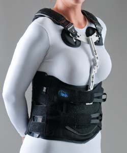 Bivalve Spinal System: Oasis Tlso/Ate, With SPX (Sternal Pad Kit with Extension Adjustment)- 3X