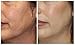 Mary Kay Timewise Microdermabrasion Plus Set