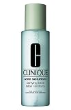 31T2mBX5gjL. SL160  CLINIQUE Acne Solutions Clarifying Lotion    3.4 oz