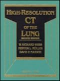 High-Resolution CT of the Lung