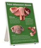 Pelvic Inflammatory Disease Easel Display