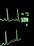 Medical Monitor Displaying Pulse and Heart Rate Data During Surgery Photographic Poster Print by Greg Dale, 12x16