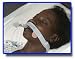 Dale Endotracheal Tube Holder Neckband - One Size Fits All - Each