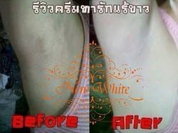 12 X 5 G New White Skin Under Arm Lightening Cream Alpha-arbutin Vitamin B3