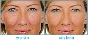 Perfekt &amp; Go (Radiant)