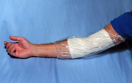 fmc colonia dialysis middle