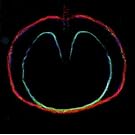 Wasp Star: Apple Venus 2