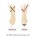 Vionic with Orthaheel Dress Slimfit