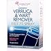 Carnation Verruca and Wart Remover Freeze Spray
