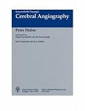 Cerebral Angiography