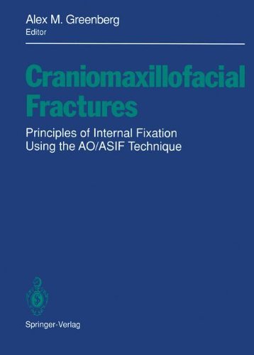 Craniomaxillofacial Fractures: Principles of Internal Fixation Using the AO/ASIF Technique