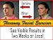 Flexaway System Facial Exerciser Kit