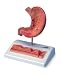 3B Scientific Scientific Stomach with Gastric Ulcers Model; Section of Stomach Wall Enlarged